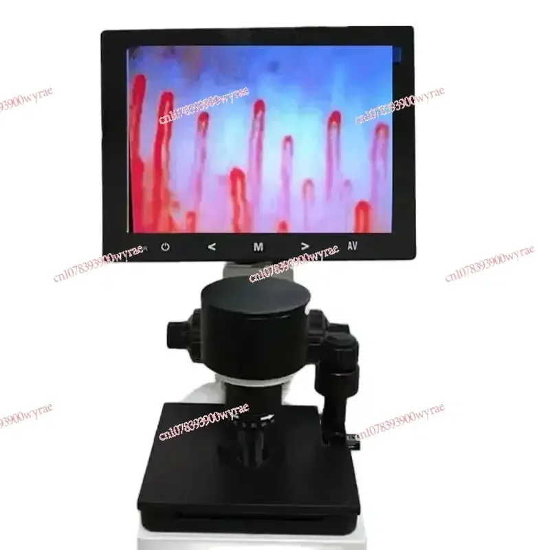 Digital Microscope Zoom Nailfold Capillary Microcirculation Detector HD Finger Peripheral Vascular Blood Flow Observation