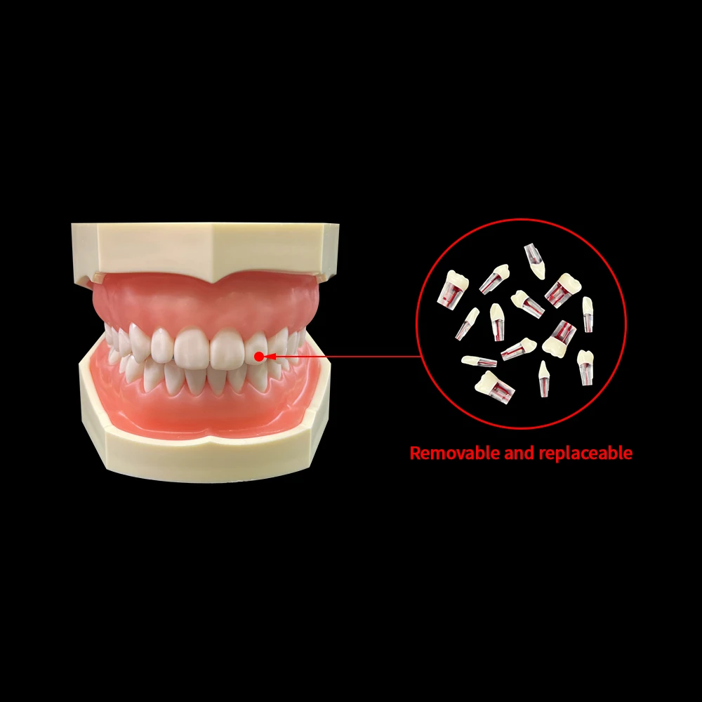 4Box Dental Teeth Root Canal Model Endodontic RCT Block Pulp Cavity Practice Model Study Endo Student Train Study Resin Replace