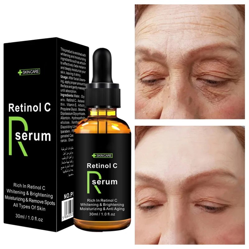 

Retinol Moisturizing Face Serum Whitening Skin Tone Essence Fade Acne Mark Improve Melanin Firm Lifting Beauty Products 30ml