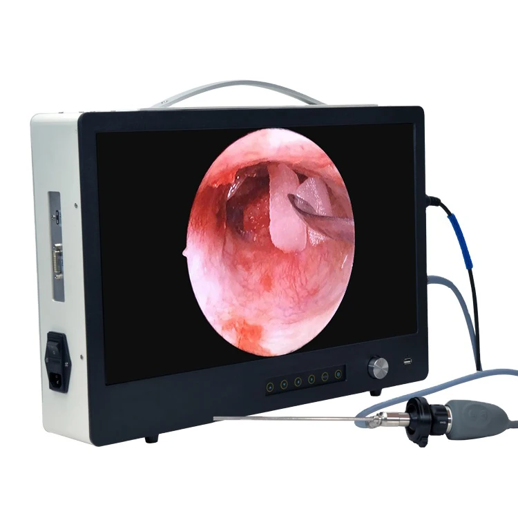 

Surgical instrument portable 19 inch HD Nasal endoscope camera