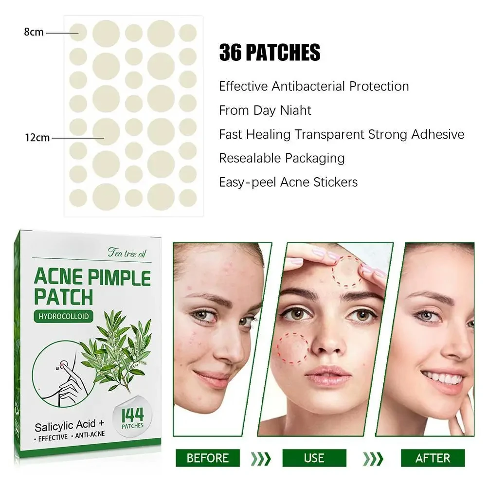 144pcs Hydrocolloid Salicylic Acid Acne Pimple Patches Treatment For Zits Blemishes Tea Tree Oil acne patch For Inflamed Acne