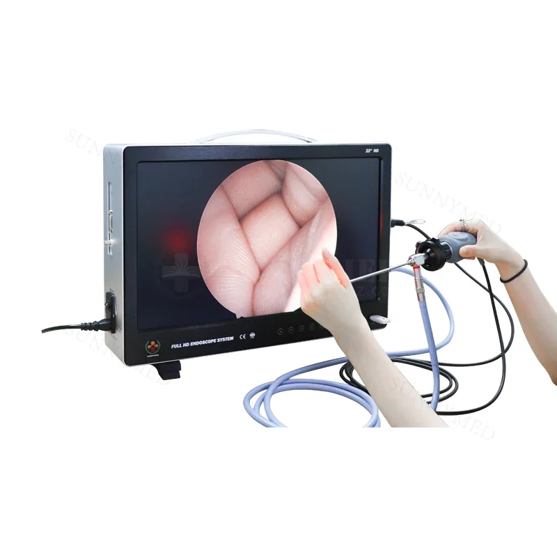 1080p full hd  endoscope system ent endoscopy hd  endoscope  arthroscope ent endoscope