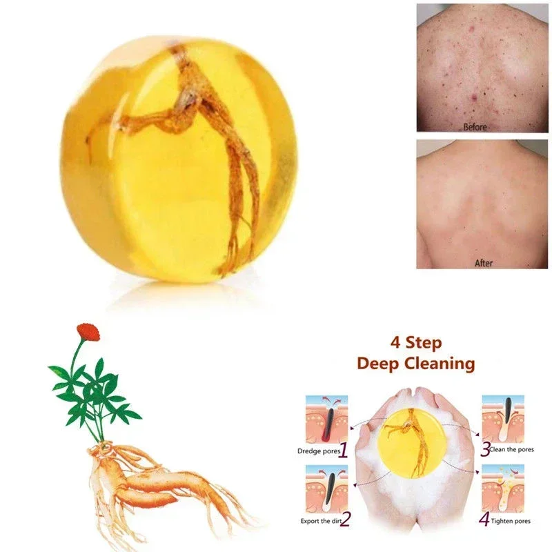 100g Natural Ginseng Handmade Soap - Anti-acne Chinese Herb Face Essential Soap for Clearer Skin