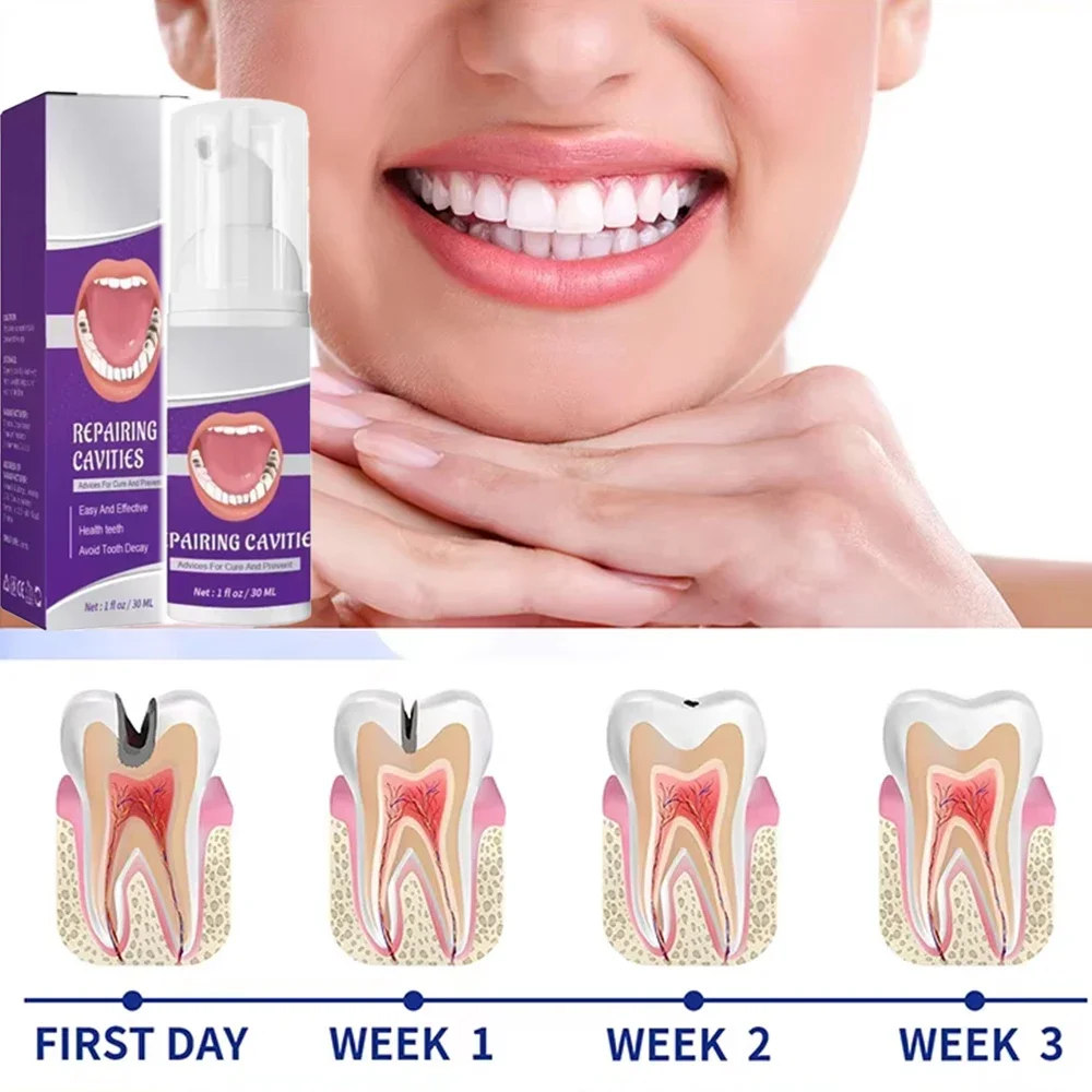 

Anti Decay Toothpaste Teeth Whitening Anti-Cavity Bad Breath Repair Tooth Decay Remove Plaque Toothache Relieve Periodontitis