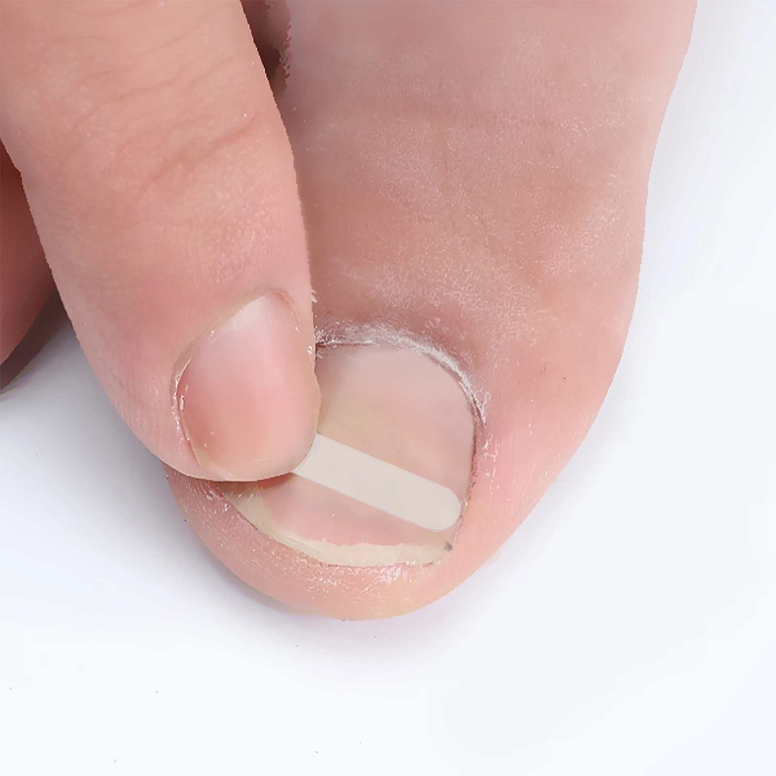 

120pcs Nail Correction Patch Ingrown Toenail Corrector Elastic Toe Sticker Strong Adhesive For Bathing Swimming