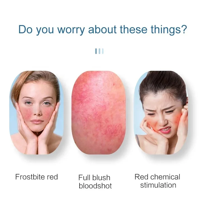 إبرة عالية التردد RF إزالة الأوردة العنكبوتية آلة مكافحة الاحمرار الأوعية الدموية الحمراء والبقع إزالة الأوعية الدموية معدات التجميل