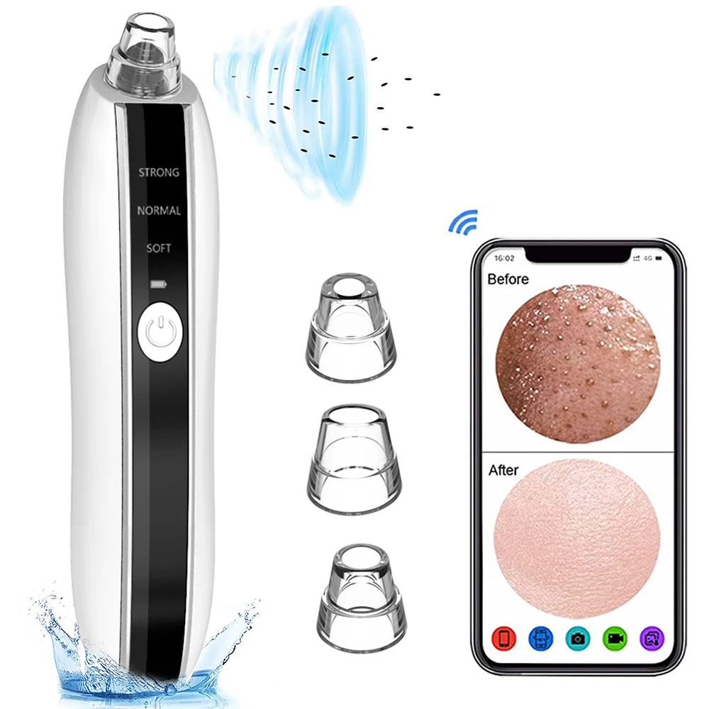 Face Comedone Acne Extractor Facial Skin Pore Cleaner Electric Sucker Vacuum Removal Blackhead Absorber camera