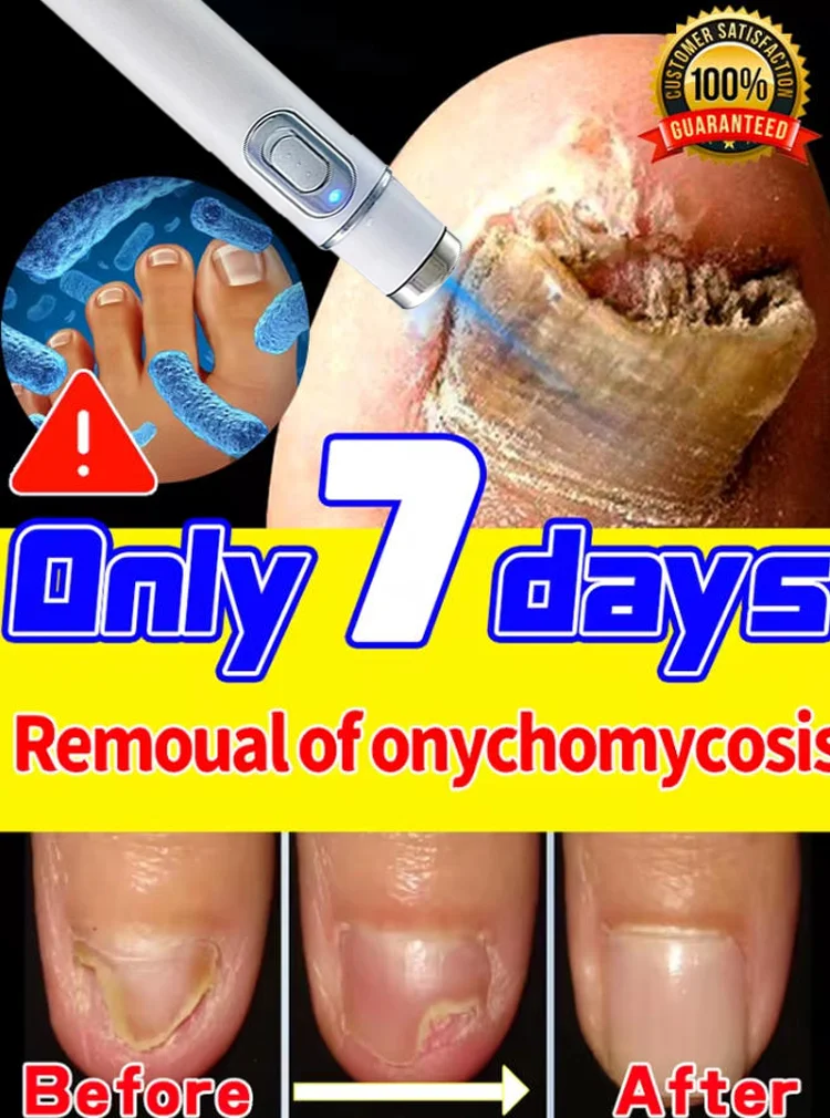 

Лазерные инструменты с синим светом, гвозди становится здоровым и гладким, без беспокойства о грибковых инфекций ногтей.