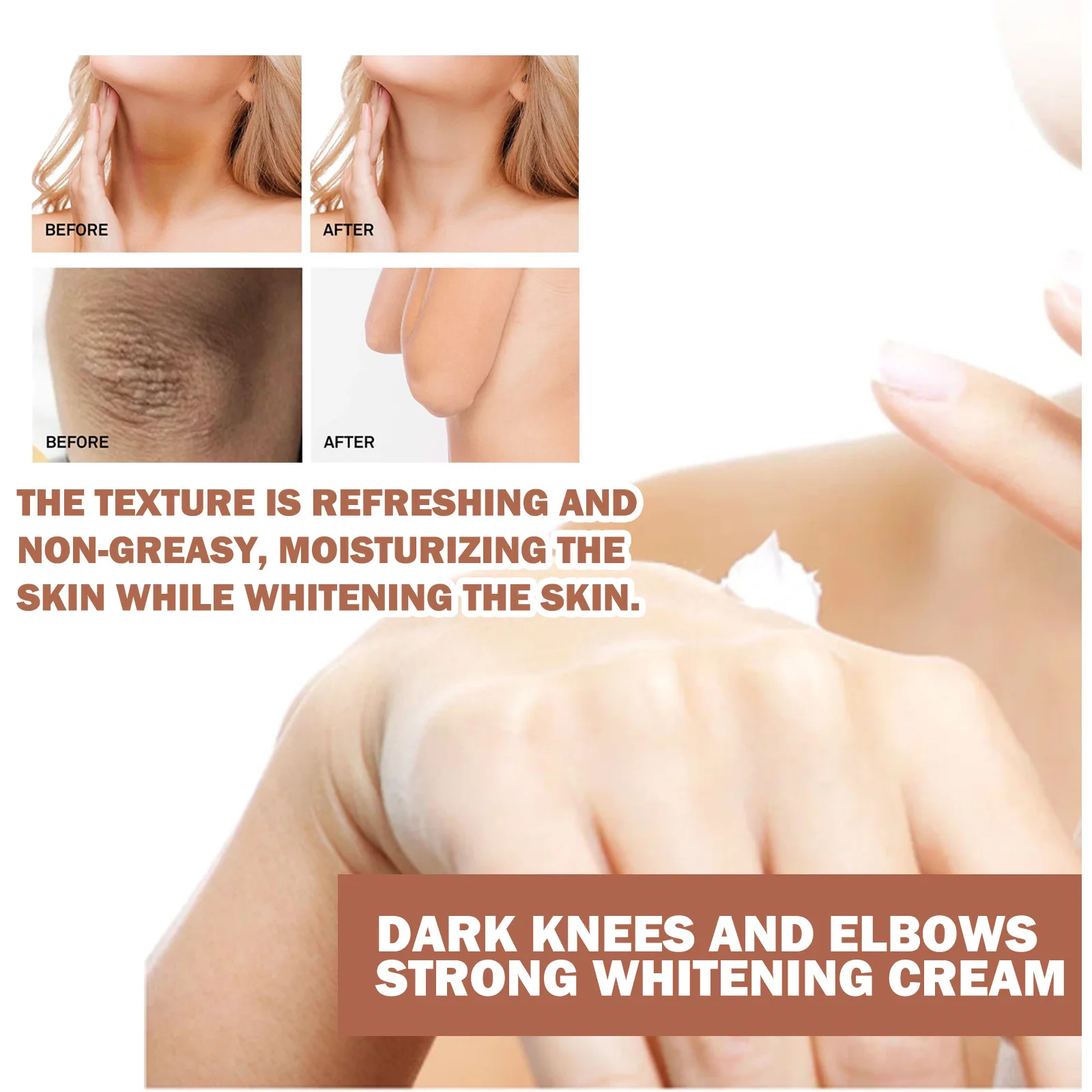 Dark Knuckles Creme Clareamento Rápido, Corretores de Pigmentação para Pele Negra, Mão Knuckle, Cotovelos, Joelho, Creme Removedor de Manchas Intensa