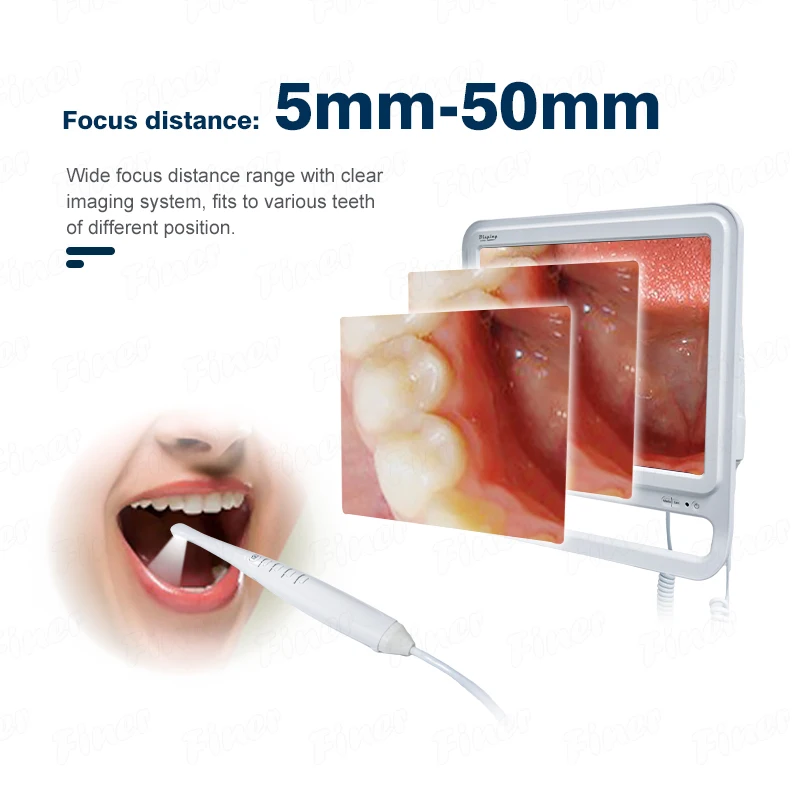 Dental Intra Oral Camera Endoscope with Monitor Dental Intraoral Camera Dental Endoscope