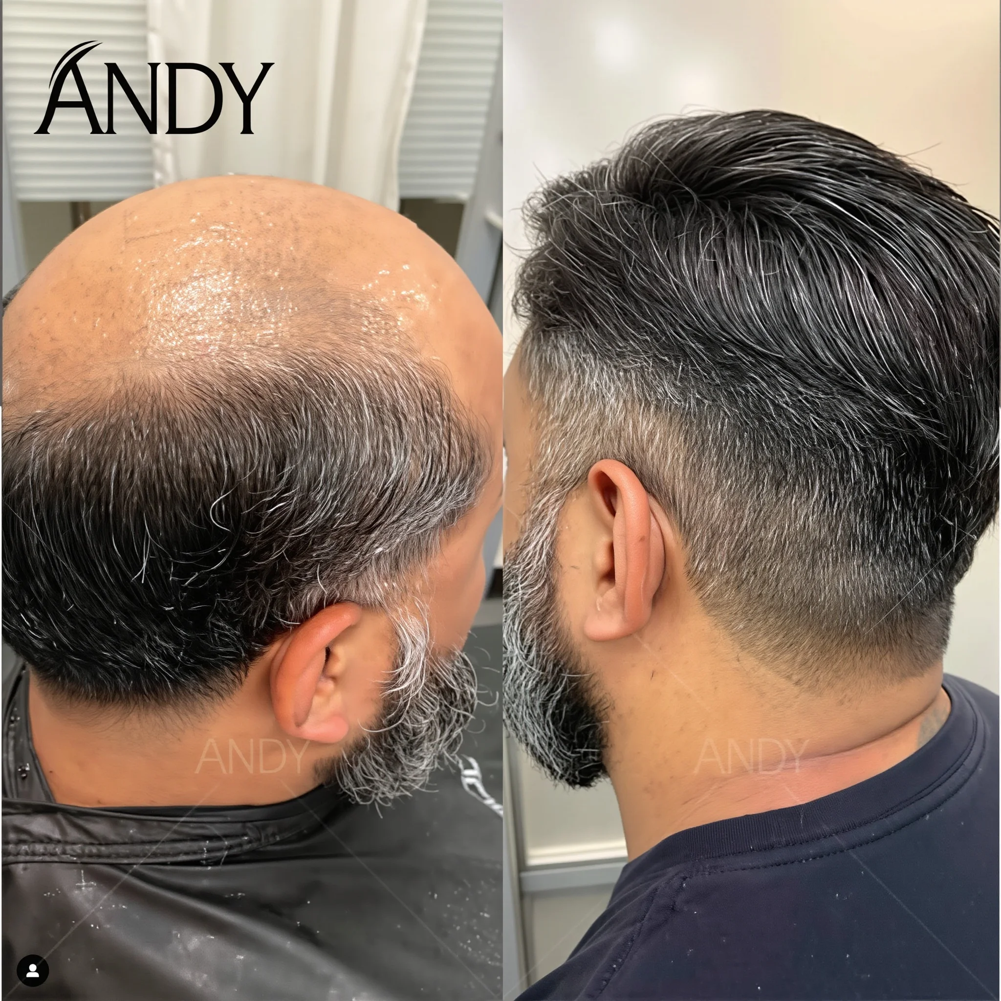 

Durable Thin PU Skin Base Male Toupee Unprocessed Human Hair Natural Looking Hairline Comfortable Wear Men Hair Patch