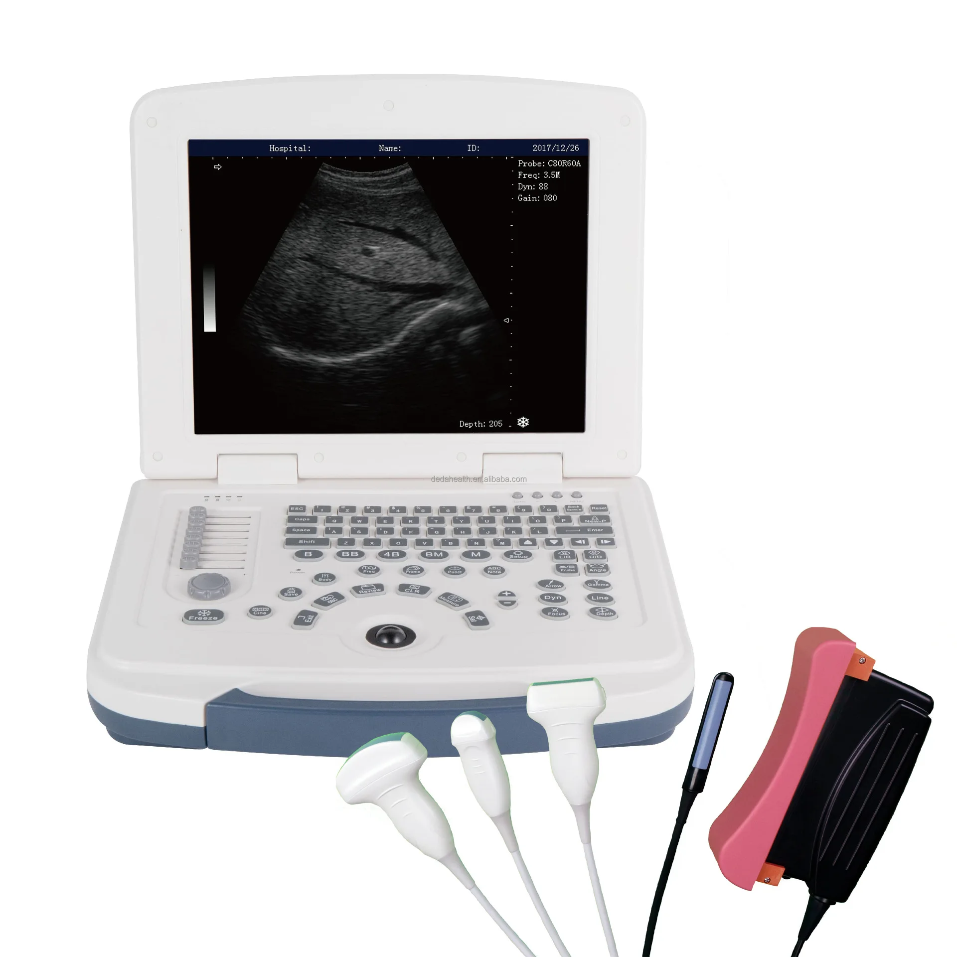 High definition human and animal universal B ultrasound machineDW580portable Doppler ultrasonic scanner color ultrasound machine