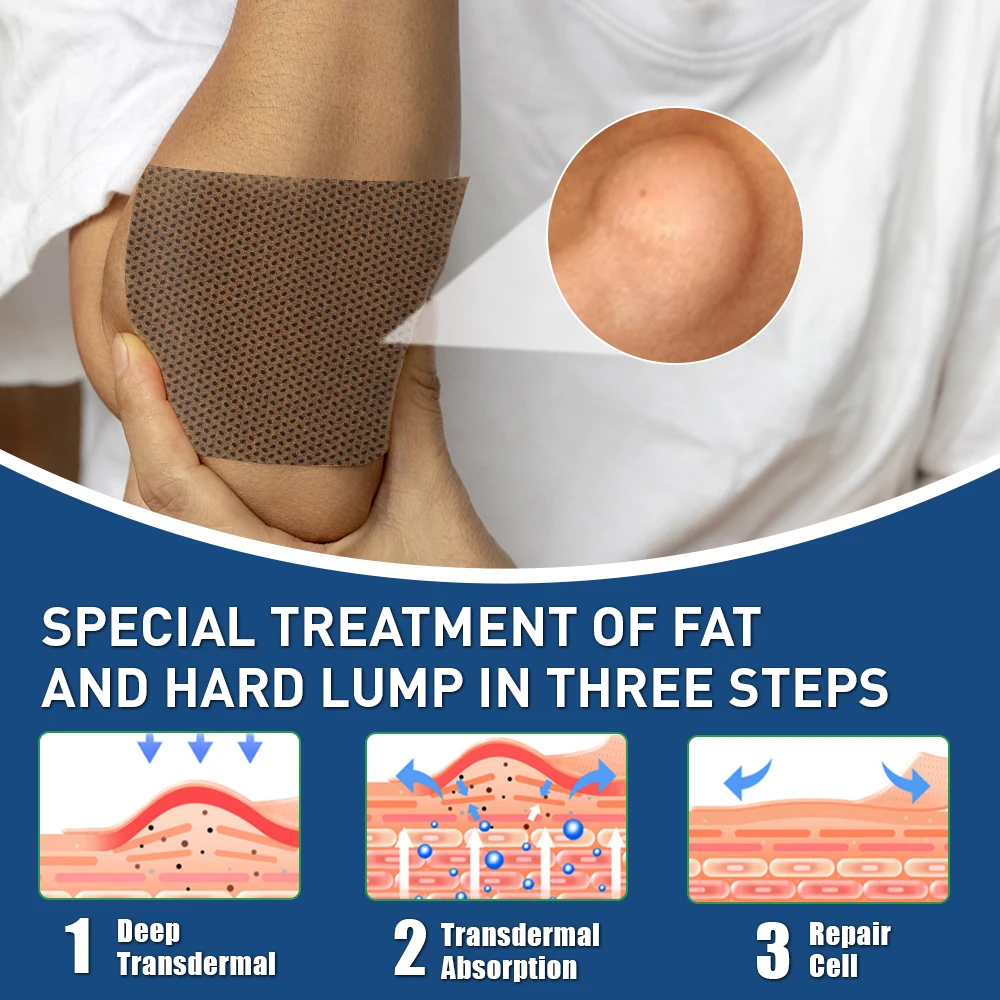 Sumifun 6pcs Lipoma Removal Patch Reduce Inflammation Anti-tumor Medical Treatment Cyst Swelling Nodular Relief Pain Plaster