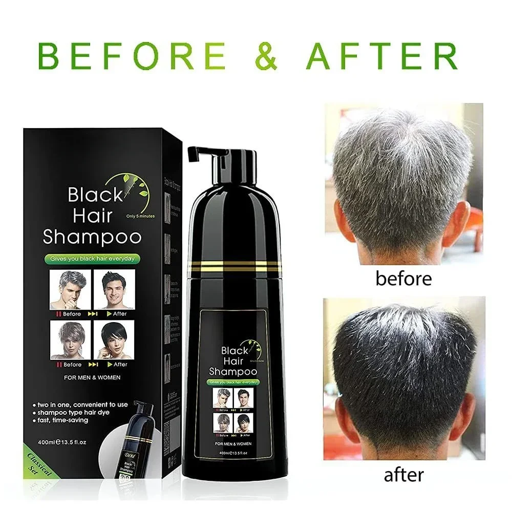 

400ml Plant Hair Dye Dyeing and Protecting One Covering White Hair Combing Black Men and Women Natural Black Dyeing Cream