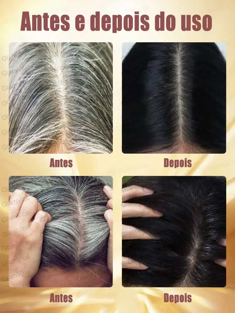 crecimiento cabello  minoxdil hair growth