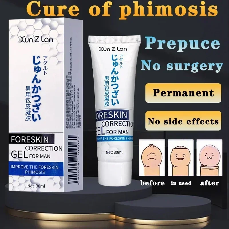 Redundant prepuce of Penis Treatment Gel Prevent Phimosis Expose The Penis Head  Without Surgery Male Prepuce Retraction Cream