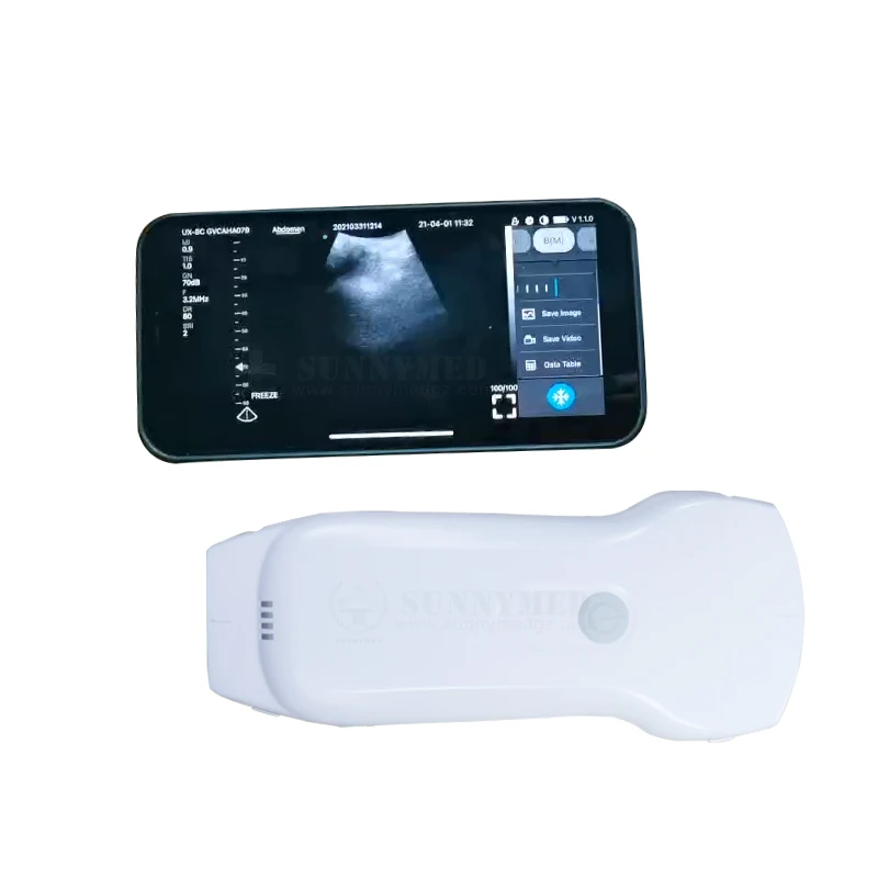 SY-A053CL Portable Wireless Portable Ultrasound Transducer 3 in 1 Cardiac Linear Convex Handheld Ultrasound Scanner