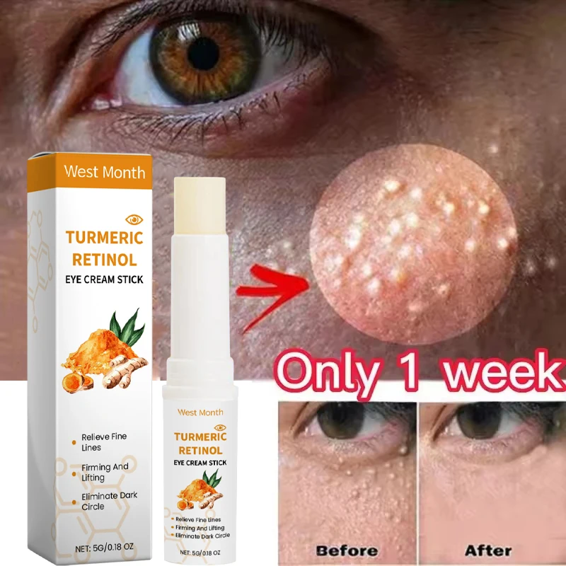 

Fat Granules Removal Eye Cream Stick Milia Treatment Eye Repair Products Anti Inflammatory Anti Puffiness Korean Skin Care