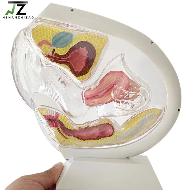 Medical Female Transparent Uterus Model Gynecological Demonstration Education