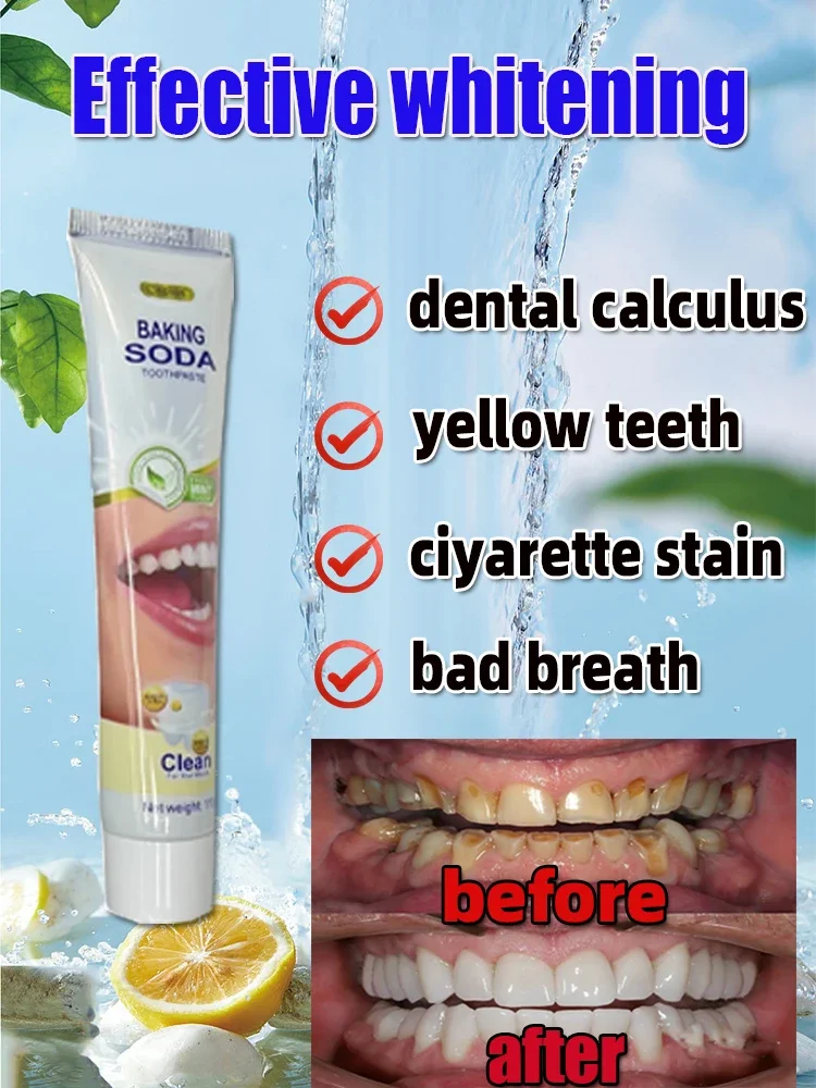 Remover Dental Calculus Whitening Teeth Mouth Odor Removal Bad Breath Preventing Periodontitis