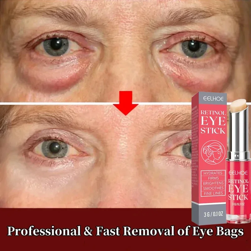 Retinol Eye Bags Cream Anti Dark Circles Instant Wrinkle Remover Aging Fine Lines Whitening Moisturizing Eye Skin Care Cosmetics