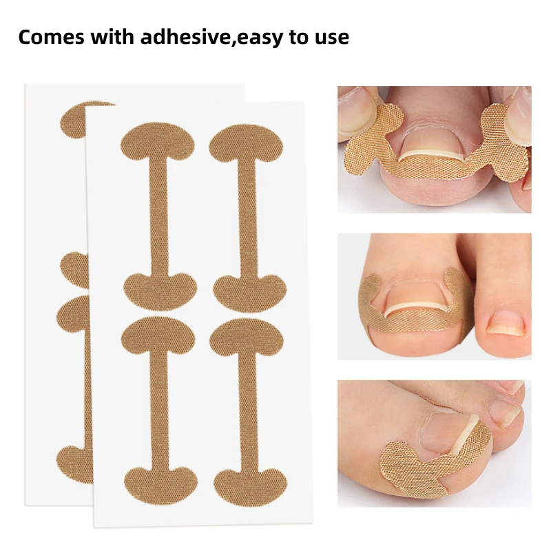 8Pcs=2Sheets Ingrown Toenail Correction Sticker Adhesive Toenail Patch Elastic Treatment Corrector Sticker Foot Care Pedicure