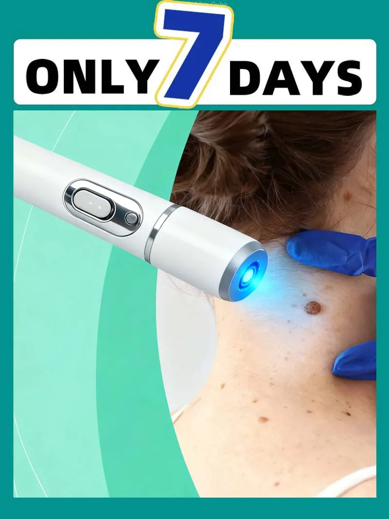 Verruca aggiornata di terza generazione riparazione radice verruche uickly Z7