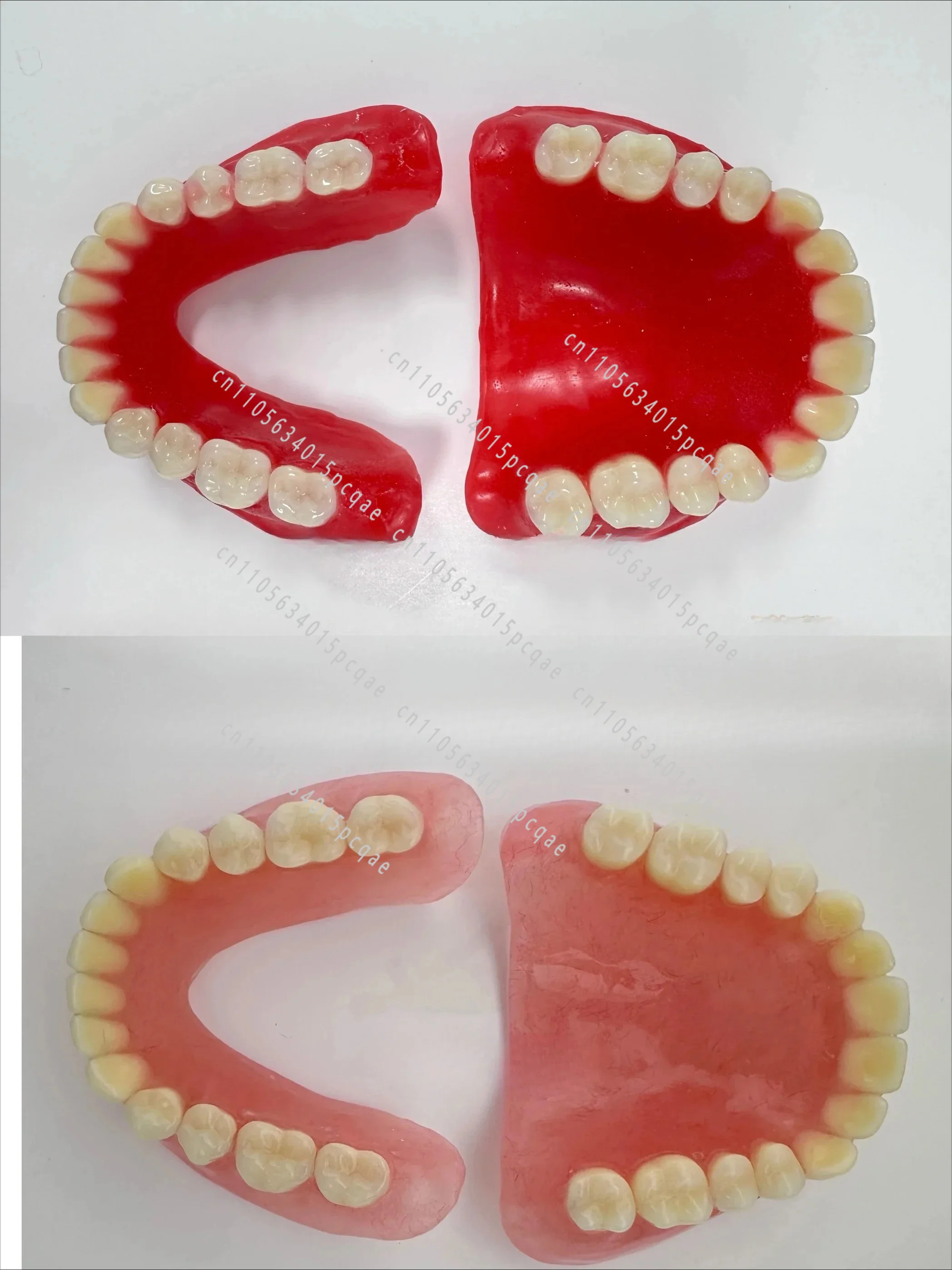 Prothèses dentaires complètes, prothèses dentaires amovibles, dents complètes pour personnes âgées, dents complètes, fournitures pour la présentation de modèles
