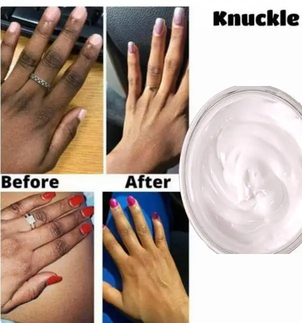 knuckle Cleanser, Serum. Dark elbow cleanser. dark hand serum. dark feet serum.dark toes serum. brightening cleanser