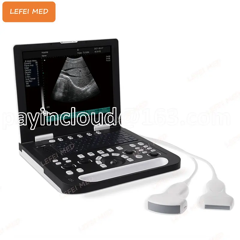 Medical Professional digital smart ultrasound potable ultrasound machine ultrasound equipment with exceptional capability