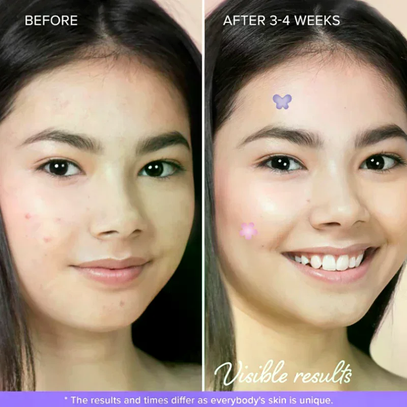 

132pcs Face Skin Care Acne Pimple Patch Invisible Professional Healing