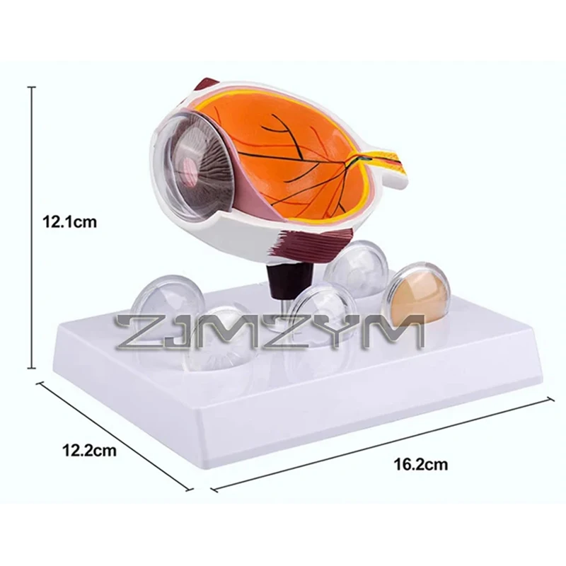 Human Cataract Eye Anatomical Model Anatomy Medical Teaching Model