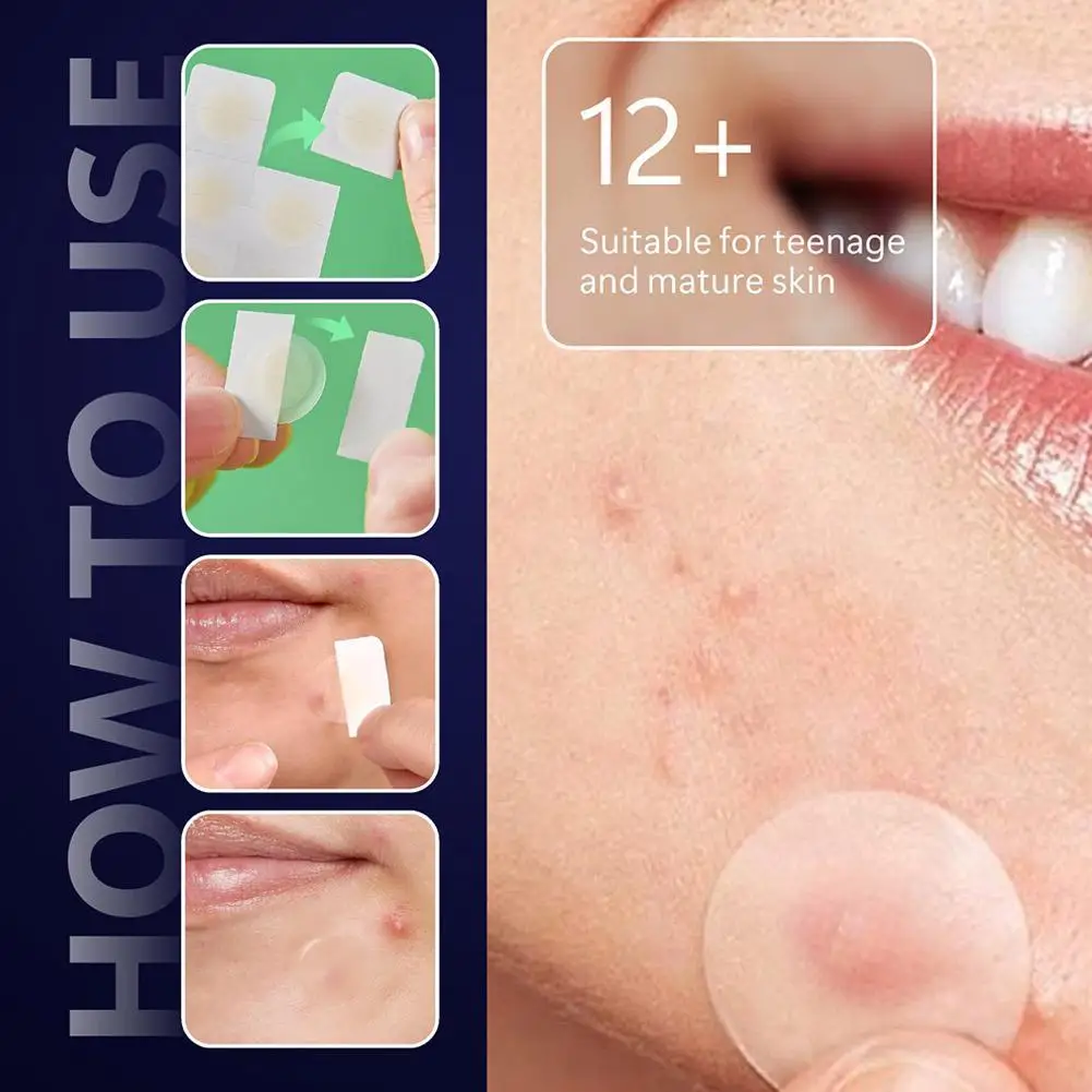 Hydrocolloid Pimple Patch Micro Needle Acne Patches Ultra-thin Invisible 8 Hours Effective Acne Cover Sticker Facial Care Tool view 3