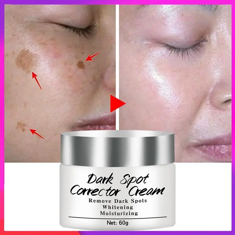 Newest Dark Spots Corrector Cream Whitening Facial Cream Repair Fade Freckles Remove Dark Spots Melanin