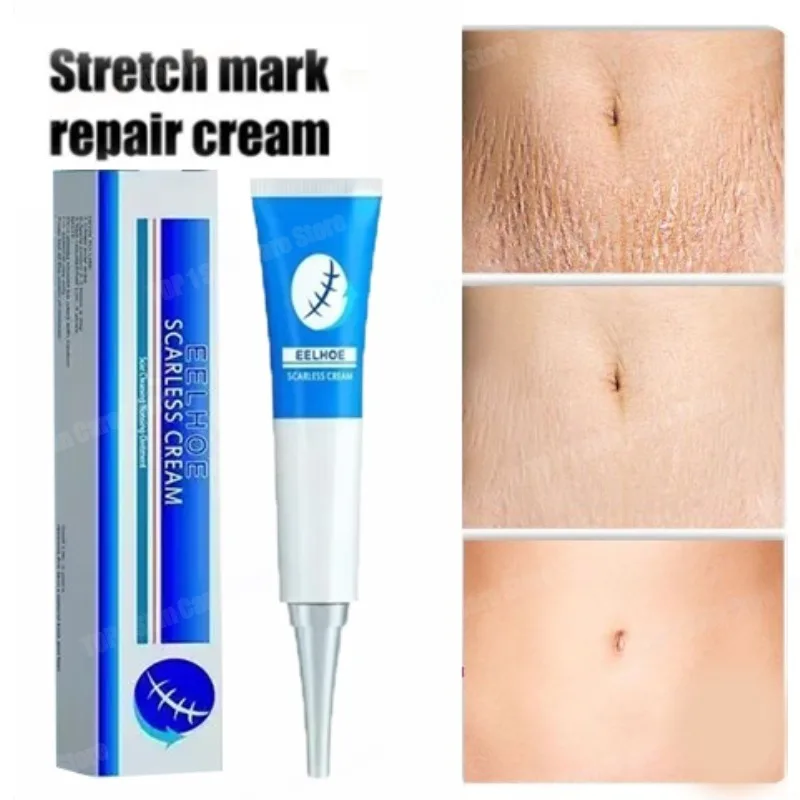 

Stretch Mark Cream Anti-wrinkle Anti-aging Maternal Skin Repair Remove Pregnancy Firms tightens skin Prevents new stretch marks