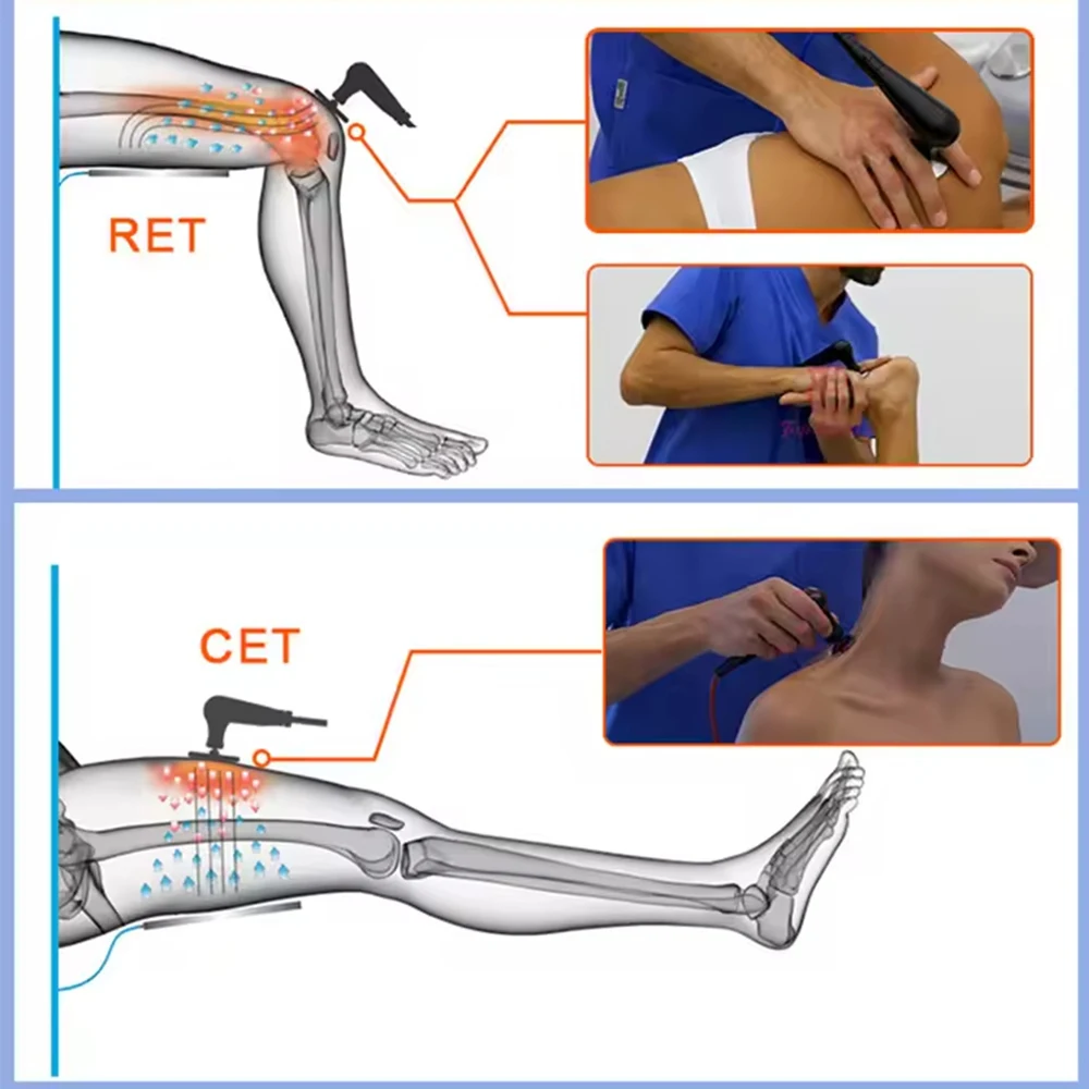 Máquina de ondas de choque de diatermia Tecar de 448khz, terapia de adelgazamiento corporal para quemar grasa, fisioterapia CET Rf, dispositivo de terapia estimular por microcirculación