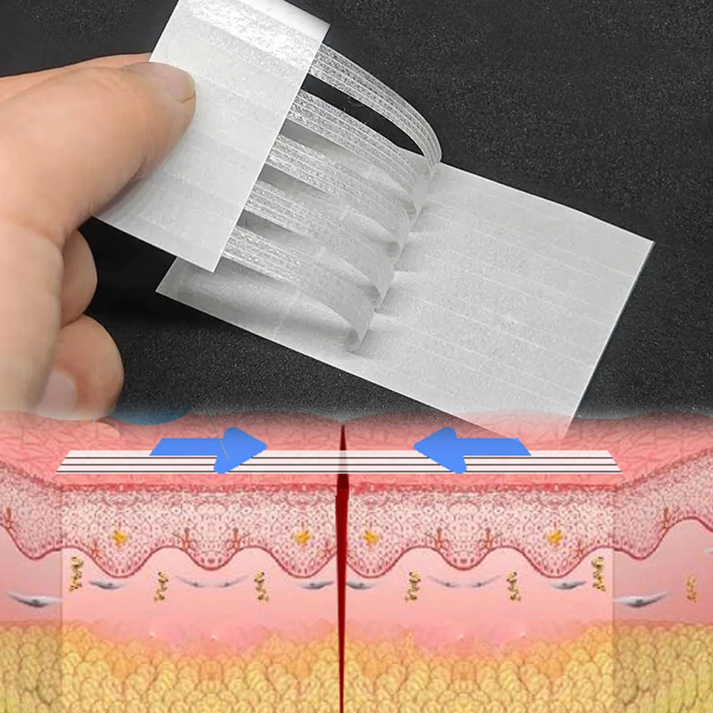 

Wound Skin Closure Strips Postpartum Wound Repair Cosmetic Surgery Seam-Free Adhesive Tape Sticker