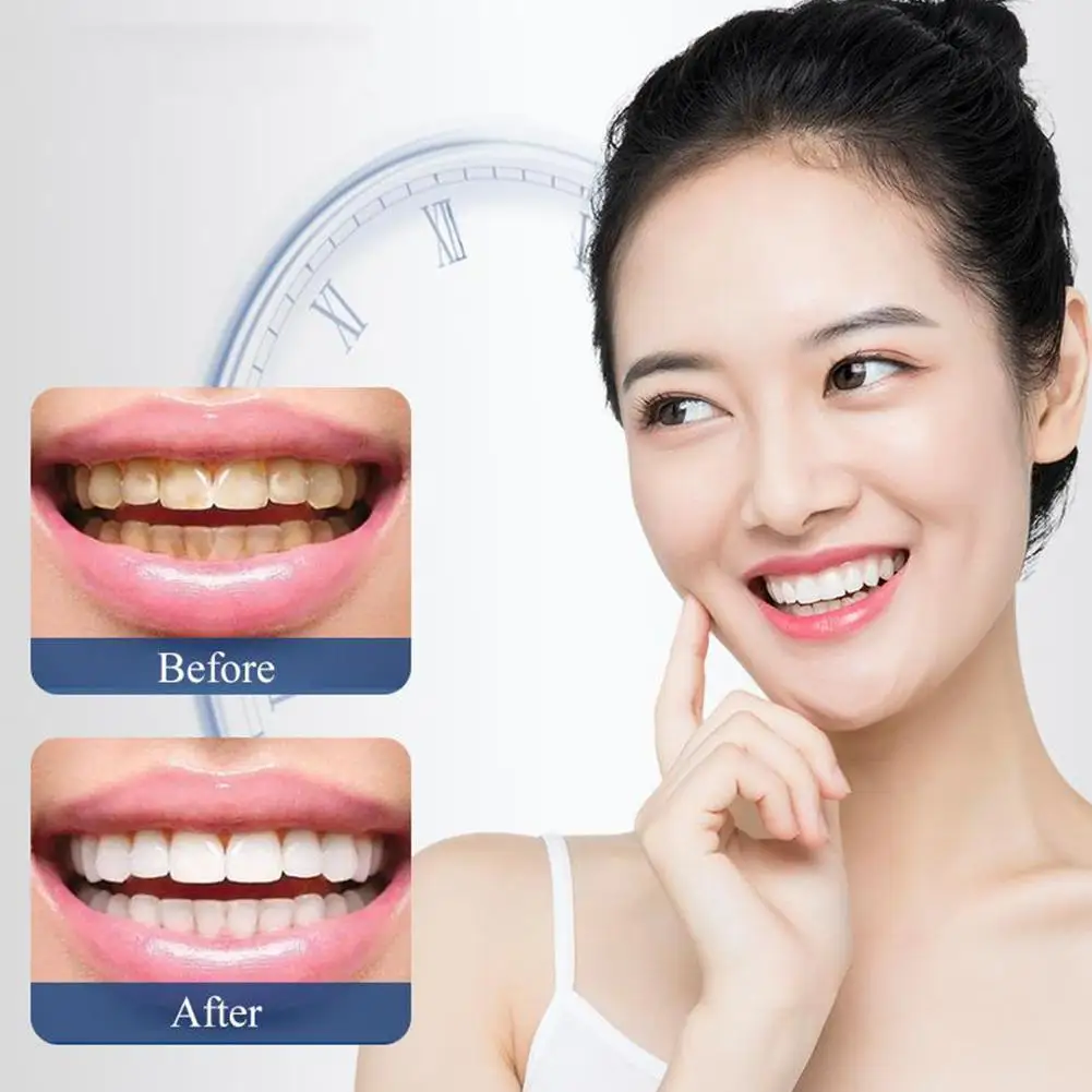 1/2pcs Quick Repair Of Cavities Caries Filling Removal Repair Stains Plaque Yellowing Teeth Whitening Whitening Teeth Toothpaste