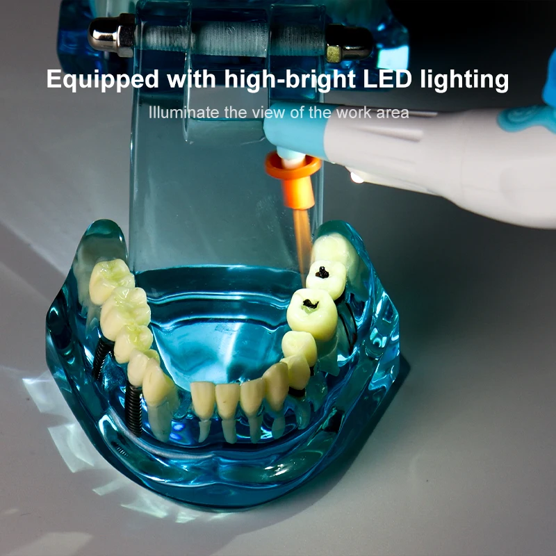 VVDental Endoaktivator Kabelloser Ultraschall-Aktivator Zahnwaschgerät mit 30 Spitzen für die endodontische Wurzelkanalbehandlung – Detail 3
