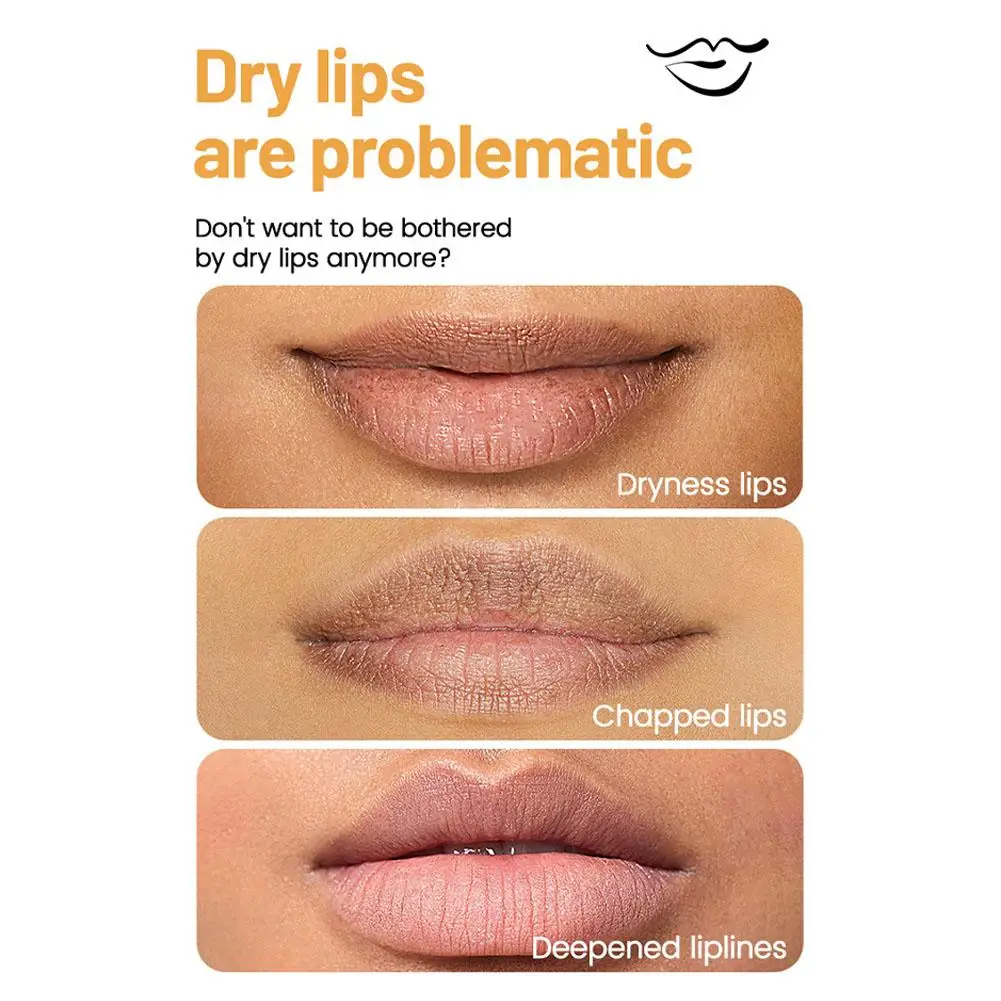 6-teiliges Lippenbalsam-Set mit verschiedenen Fruchtaromen - Feuchtigkeitsspendend, pflegend & beugt rissigen Lippen vor - Pflege für trockene Lippen & feine Linien – Detail 12
