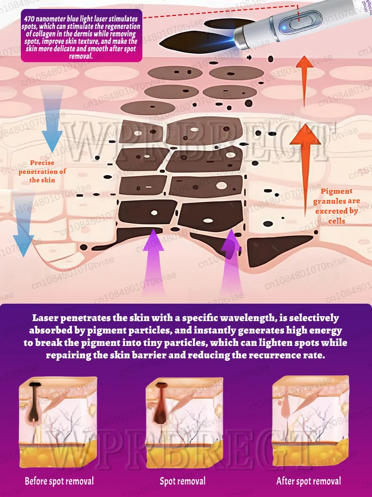 〔Hot sale〕Effectively solve the problem of ᴘɪɢᴍᴇɴᴛ ᴀᴄᴄᴜᴍᴜʟᴀᴛɪᴏɴ and say goodbye to pigmentation