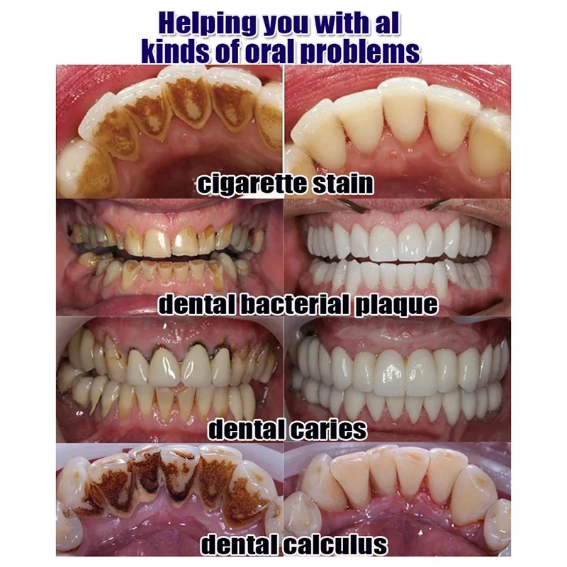 Pasta de dientes para eliminar el mal aliento, elimina el cálculo, previene la Periodontitis, limpia y cuida los dientes amarillos