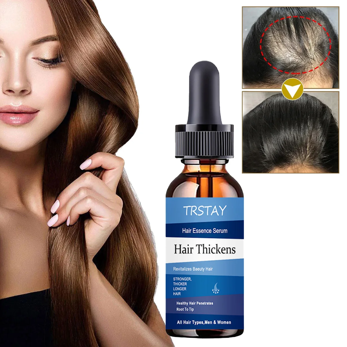 

TRSTAY Hair Essence Revitalize Beautiful Hair Make Hair Thicker And Stronger Suitable for Various Hair Qualities