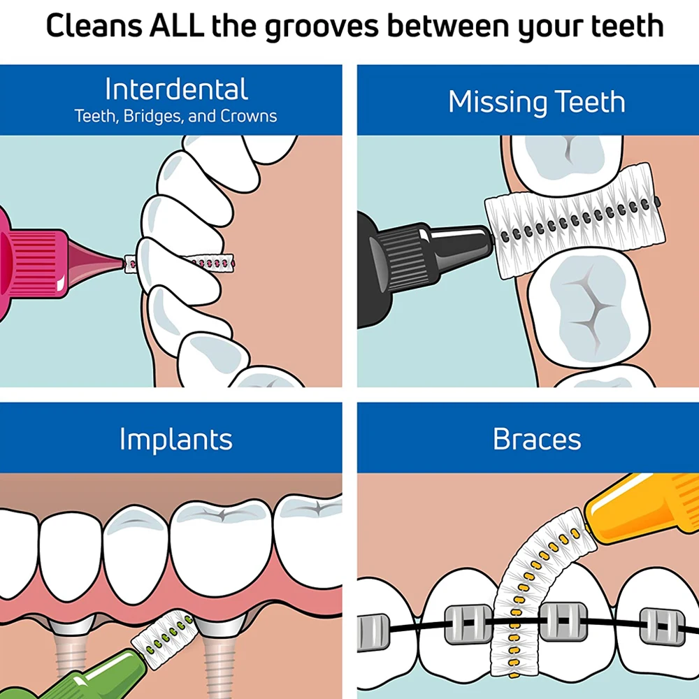Tepe-Brosse Interdentaire Originale, Dents Manquantes, Implant Couronne, Bretelles, Livres, Petit, Grand, Doux, Dents, Taille 3, 0, 1, 2, 4, 5, 6, 8 mm
