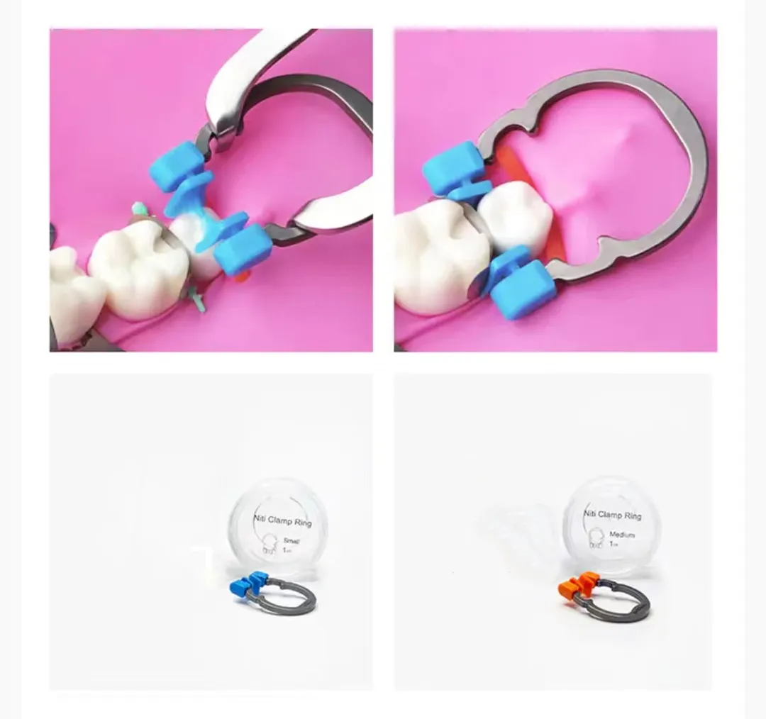 Dentales Sektionalmatrizensystem A2 Metallmatrizen NITI Klemm- und Trennring Keilmesser Diamantkeile Zangen Zahnmedizinisches Werkzeug – Detail 4