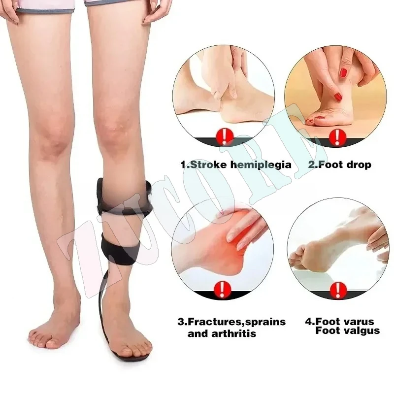Ortesis de fijación de aluminio para hombre y mujer, órtesis de tobillo y pie de fibra de carbono, soporte AFO para caída de pie, accidente cerebrovascular, disponible