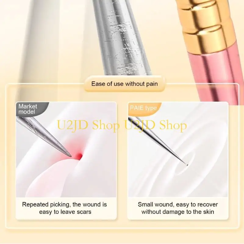 U2JD 3 in 1 acnes gereedschapset voor Blackhead en Pimple Removal met precieze pincet