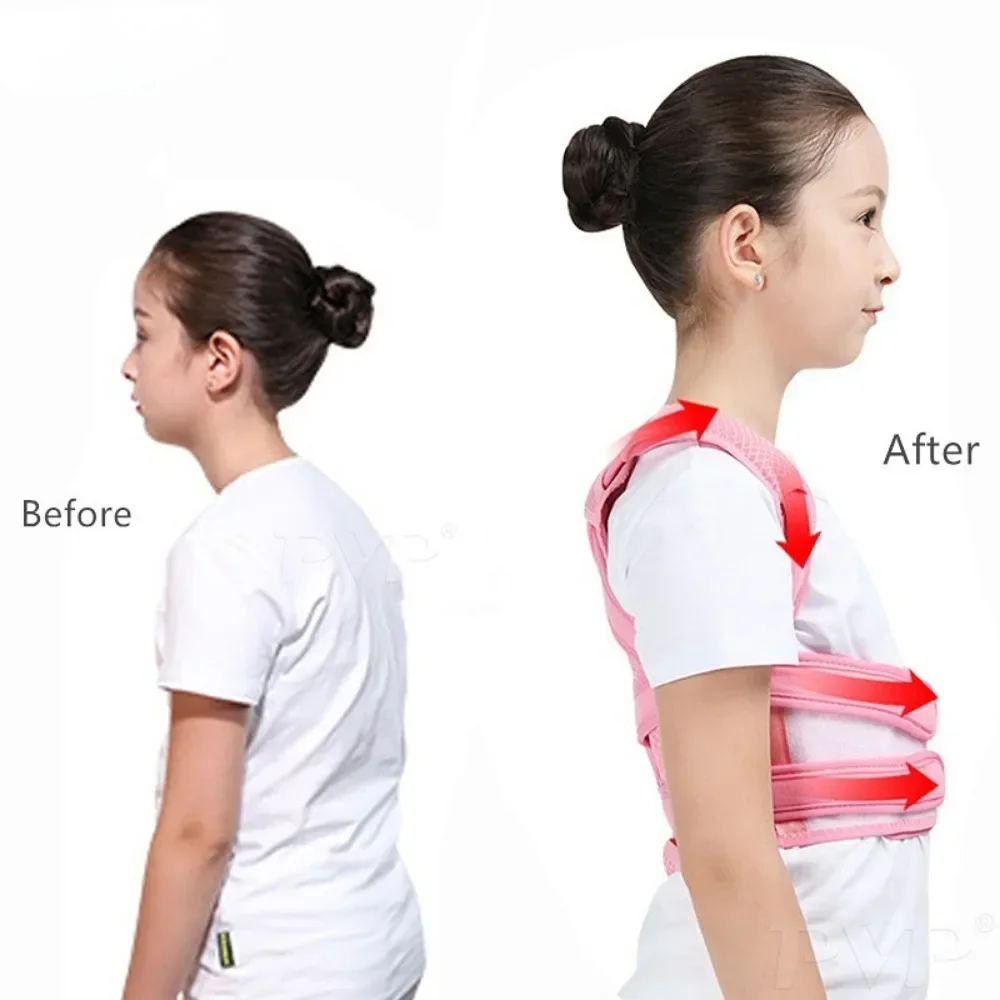 Portable Back Posture Corrector Belt Posture Brace Corset Back Corrector Belts Vest Column Posture Correction Unisex New