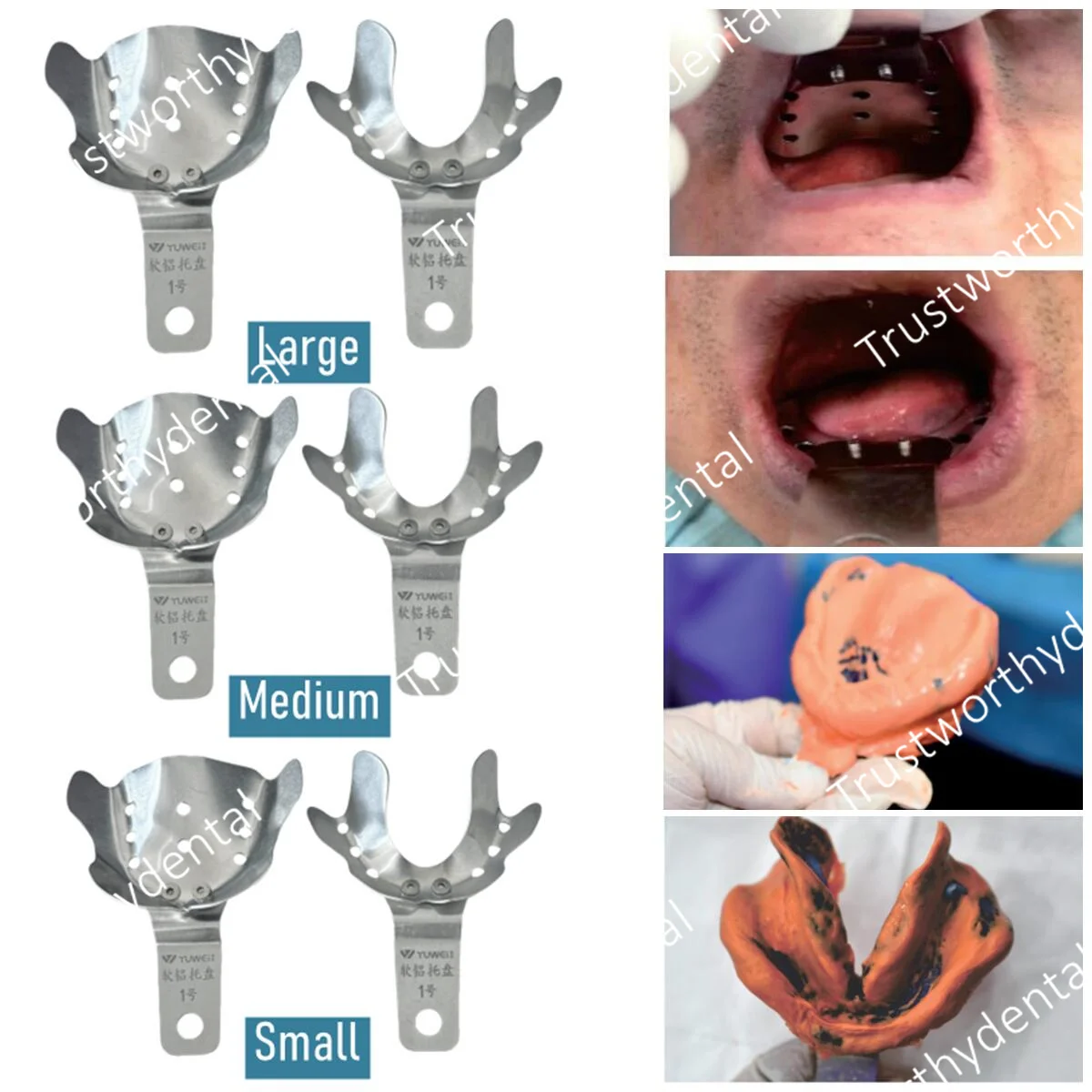 Dental Impression Tray Soft Aluminum L/M/S Detachable No Pressure Bend Trays 2-Layer Upper Teeth Lower Teeth