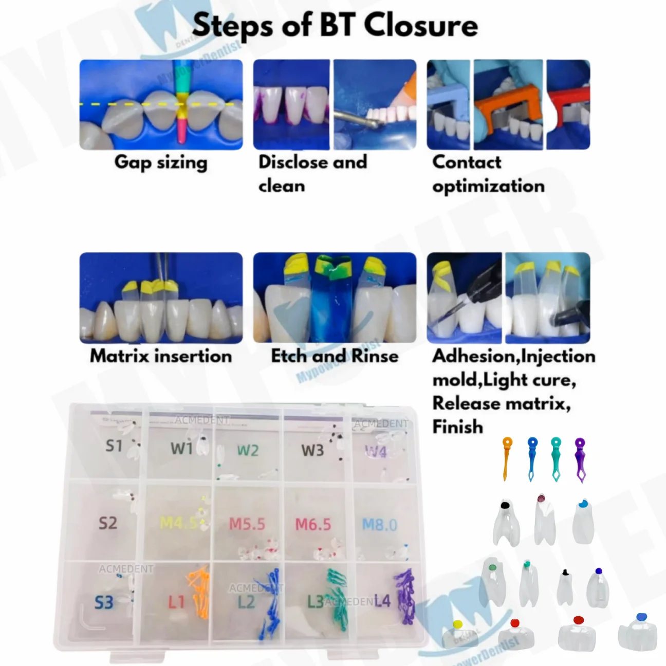 1Kit Dental Clear Matrix Diastema Matrices Wedges Similar with BioClear Matrice